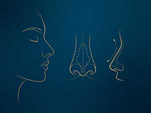Mengapa perbaikan hidung lebih sulit daripada hidung pertama? Mengapa perbaikan hidung lebih sulit daripada hidung pertama?